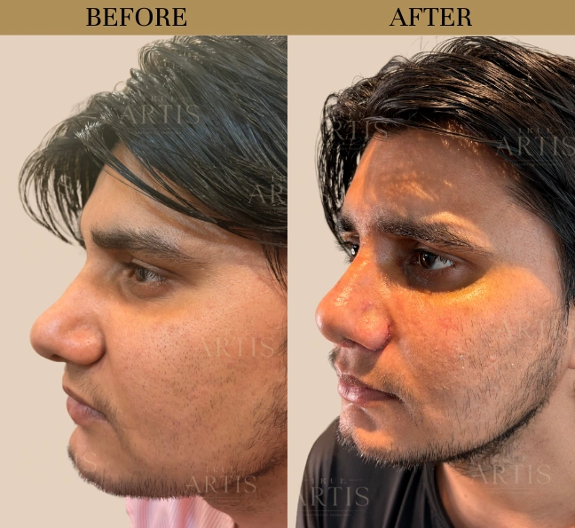 Before After