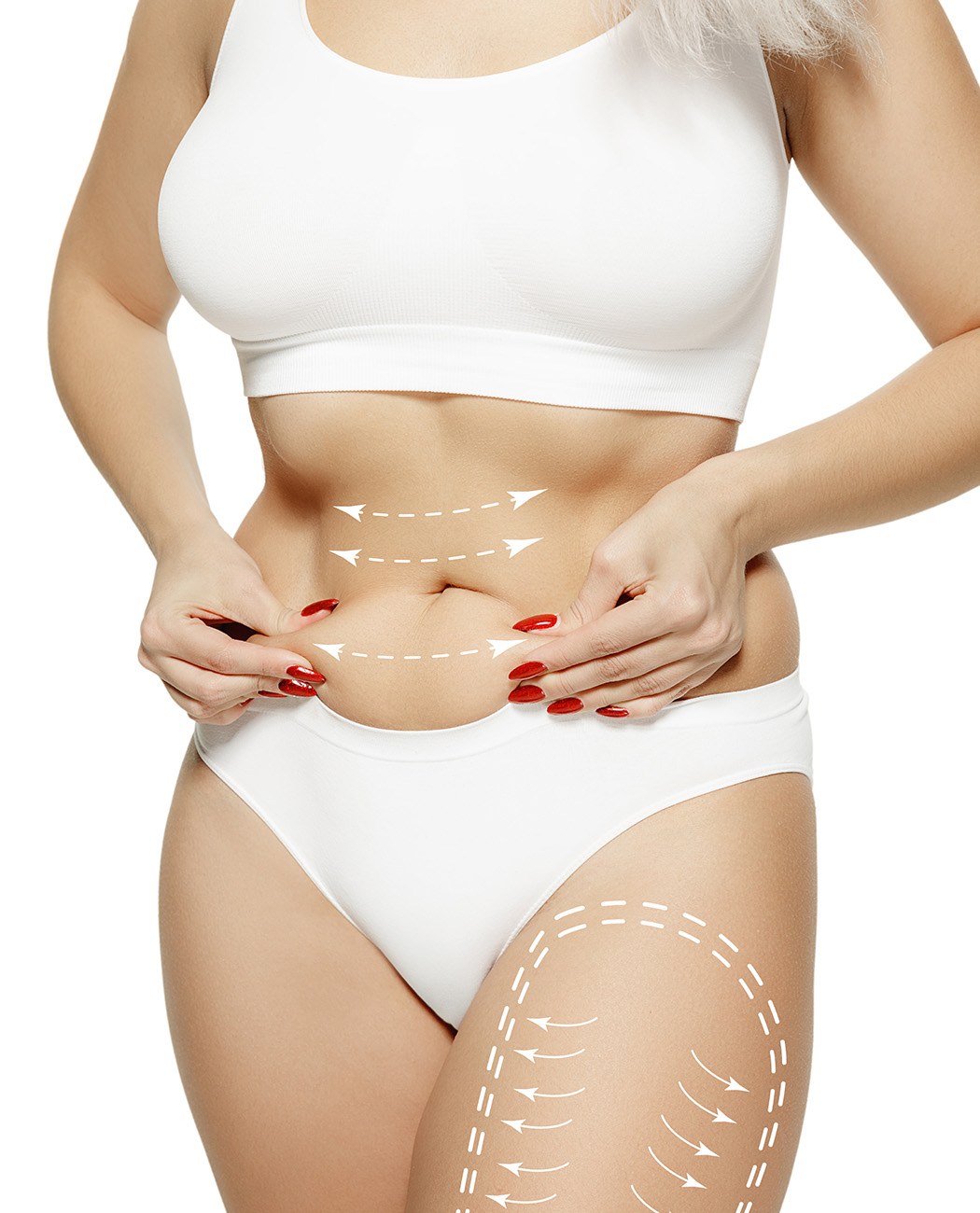 Who is an Ideal Candidate for Mommy Makeover Surgery?