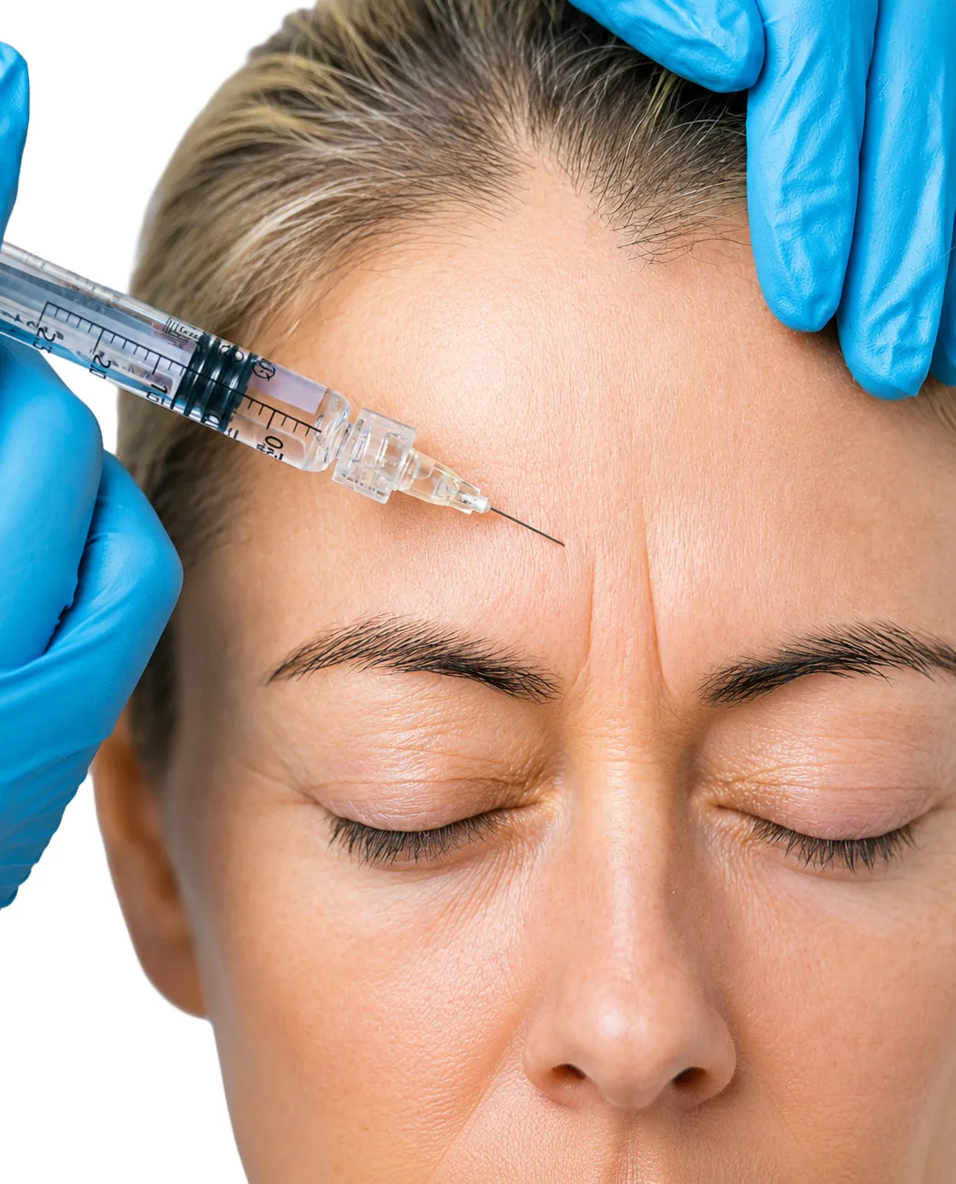 How is Botox Treatment Performed?