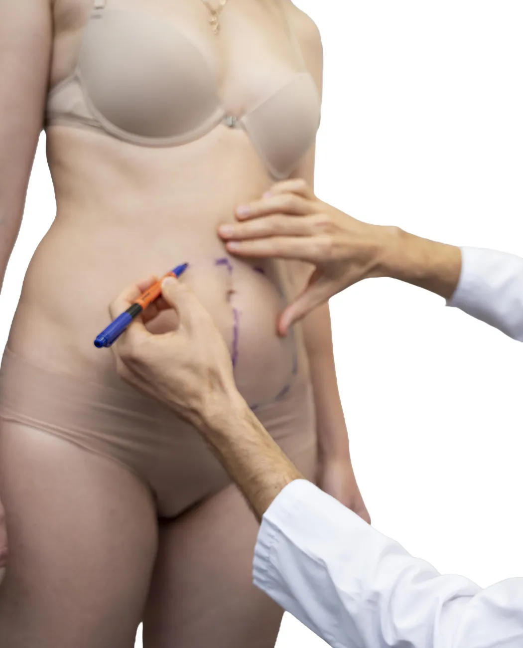 How is Post-Bariatric Body Lift Performed?