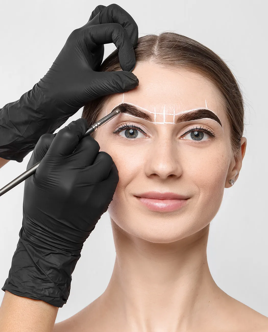How is Brow Lift Surgery Performed?