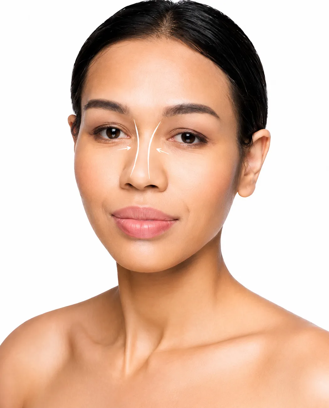 Who is an Ideal Candidate for Rhinoplasty Surgery?