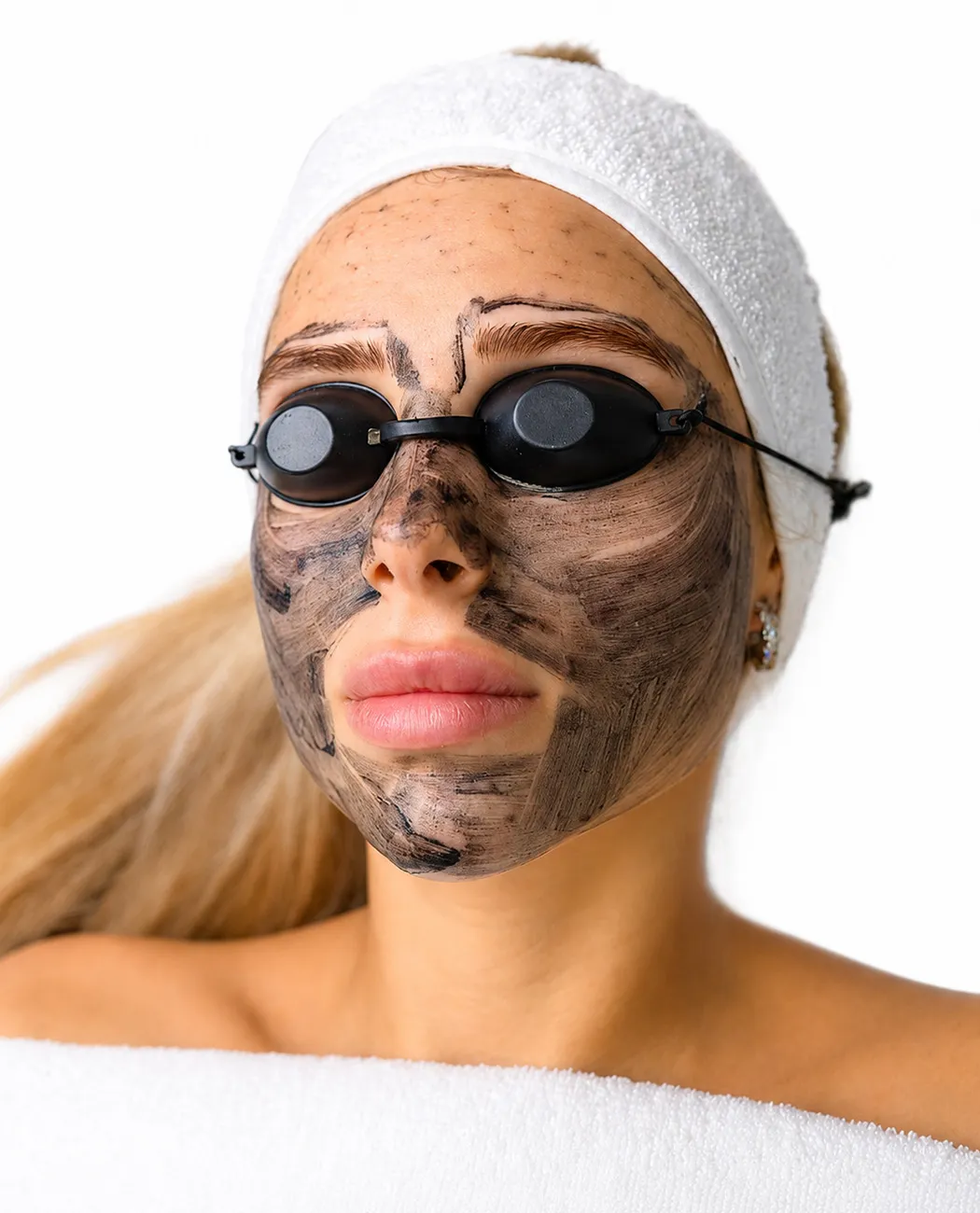 Recovery After Carbon Laser Peel Treatment: What to Expect