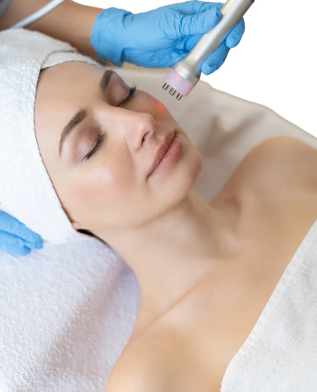 What is RF Skin Tightening Treatment?